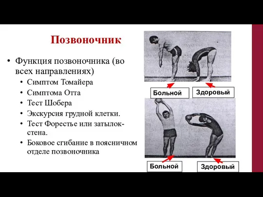 Позвоночник Функция позвоночника (во всех направлениях) Симптом Томайера Симптома Отта Тест Шобера