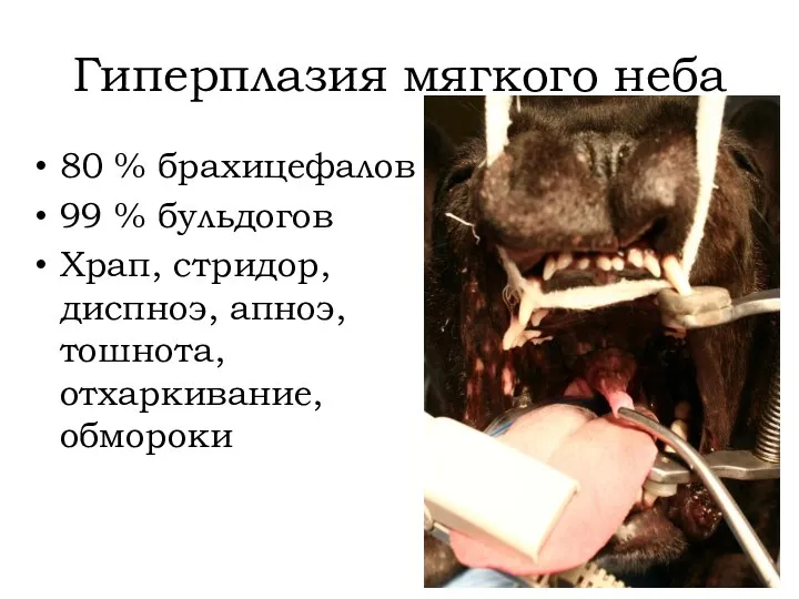 Гиперплазия мягкого неба 80 % брахицефалов 99 % бульдогов Храп, стридор, диспноэ, апноэ, тошнота, отхаркивание, обмороки