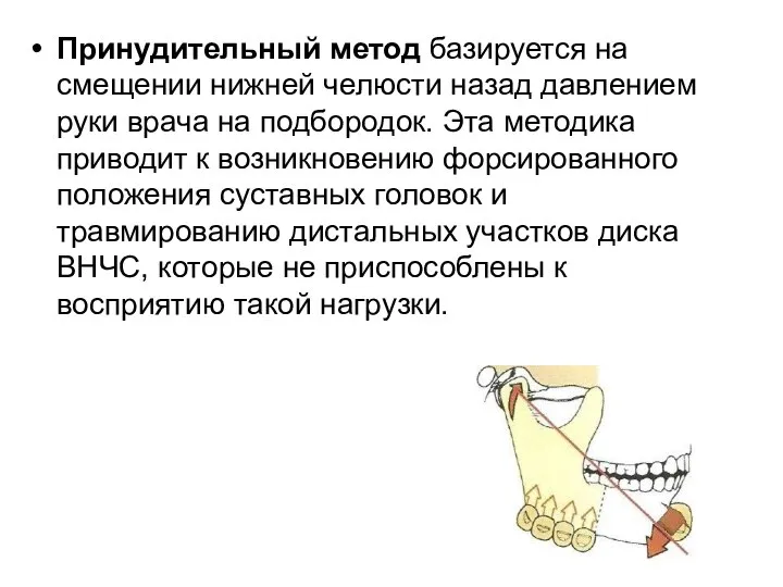 Принудительный метод базируется на смещении нижней челюсти назад давлением руки врача на