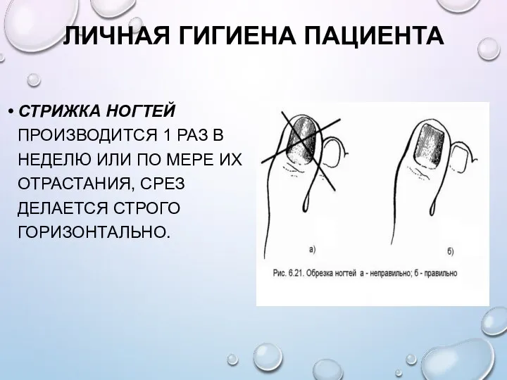 ЛИЧНАЯ ГИГИЕНА ПАЦИЕНТА СТРИЖКА НОГТЕЙ ПРОИЗВОДИТСЯ 1 РАЗ В НЕДЕЛЮ ИЛИ ПО