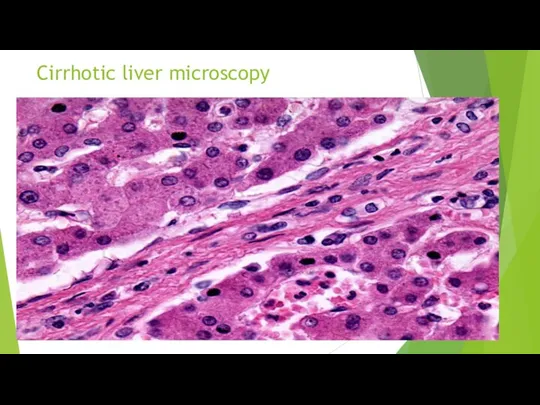 Cirrhotic liver microscopy