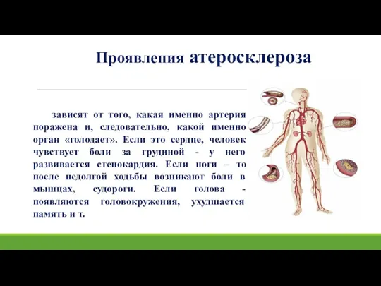 Проявления атеросклероза зависят от того, какая именно артерия поражена и, следовательно, какой