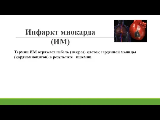 Инфаркт миокарда (ИМ) Термин ИМ отражает гибель (некроз) клеток сердечной мышцы (кардиомиоцитов) в результате ишемии.