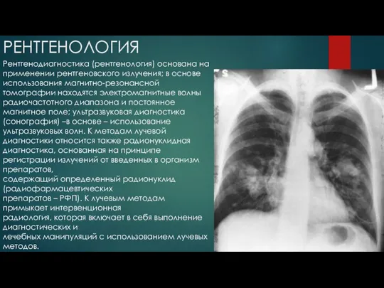 РЕНТГЕНОЛОГИЯ Рентгенодиагностика (рентгенология) основана на применении рентгеновского излучения; в основе использования магнитно-резонансной