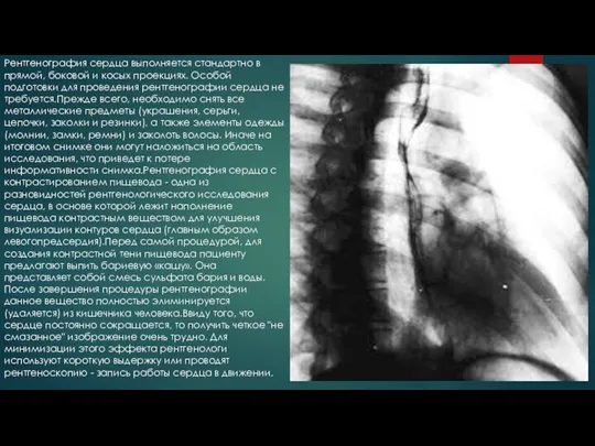 Рентгенография сердца выполняется стандартно в прямой, боковой и косых проекциях. Особой подготовки