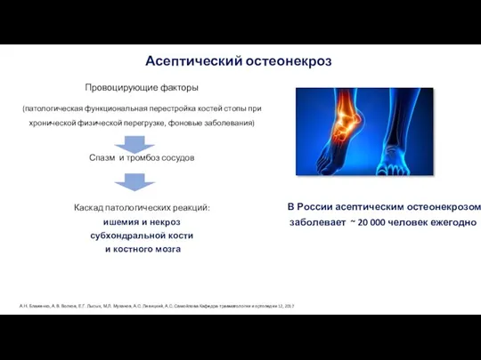 Провоцирующие факторы (патологическая функциональная перестройка костей стопы при хронической физической перегрузке, фоновые