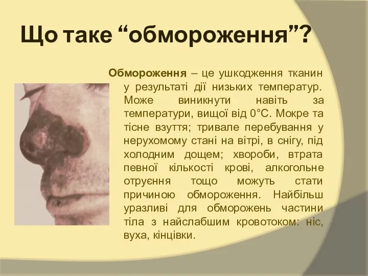 Що таке “обмороження”? Обмороження – це ушкодження тканин у результаті дії низьких