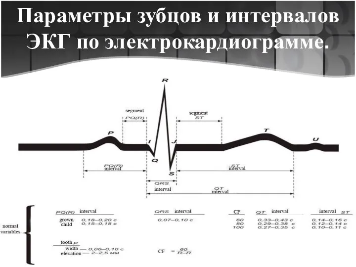 Параметры зубцов и интервалов ЭКГ по электрокардиограмме.