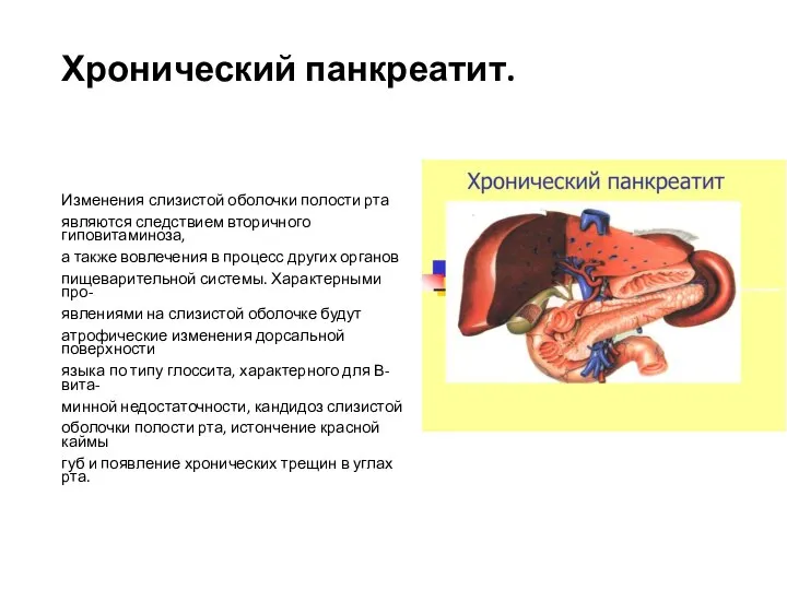 Хронический панкреатит. Изменения слизистой оболочки полости рта являются следствием вторичного гиповитаминоза, а