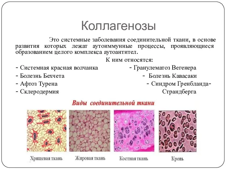 Коллагенозы Это системные заболевания соединительной ткани, в основе развития которых лежат аутоиммунные