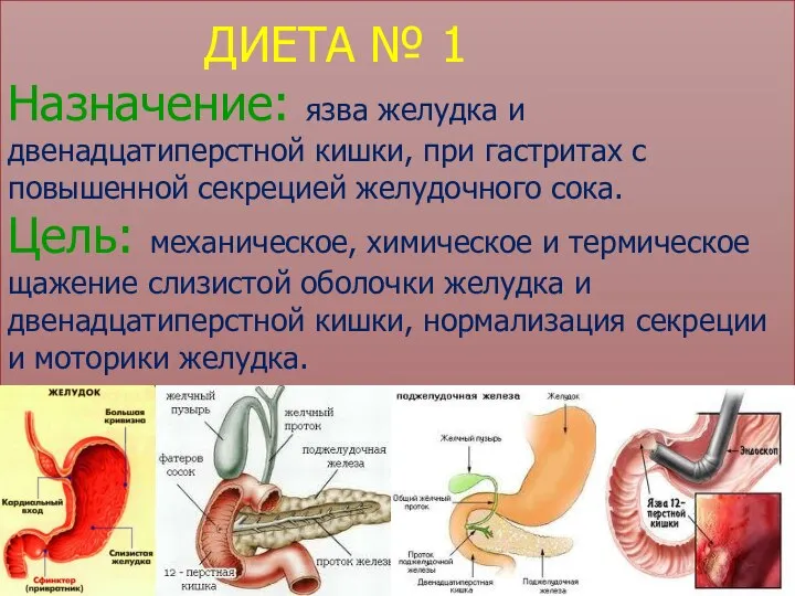 ДИЕТА № 1 Назначение: язва желудка и двенадцатиперстной кишки, при гастритах с