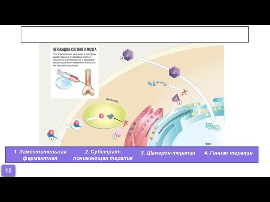 Терапия 1. Заместительная ферментная 2. Субстрат-понижающая терапия 3. Шаперон-терапия 4. Генная терапия 15