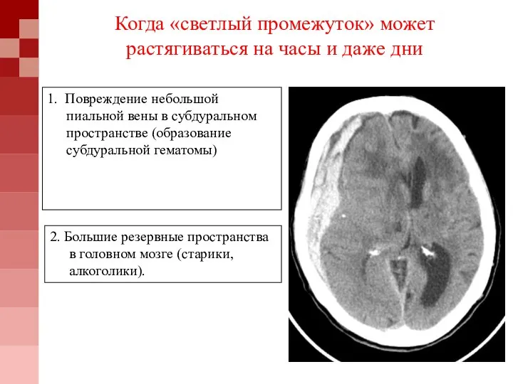 Когда «светлый промежуток» может растягиваться на часы и даже дни 1. Повреждение