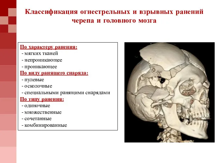 По характеру ранения: - мягких тканей - непроникающее - проникающее По виду