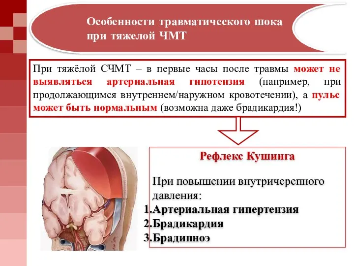 При тяжёлой СЧМТ – в первые часы после травмы может не выявляться