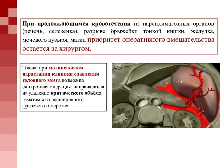 Только при молниеносном нарастании клиники сдавления головного мозга возможно синхронная операция, направленная