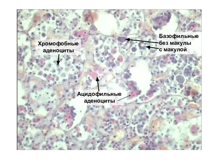 Базофильные без макулы с макулой Хромофобные аденоциты Ацидофильные аденоциты
