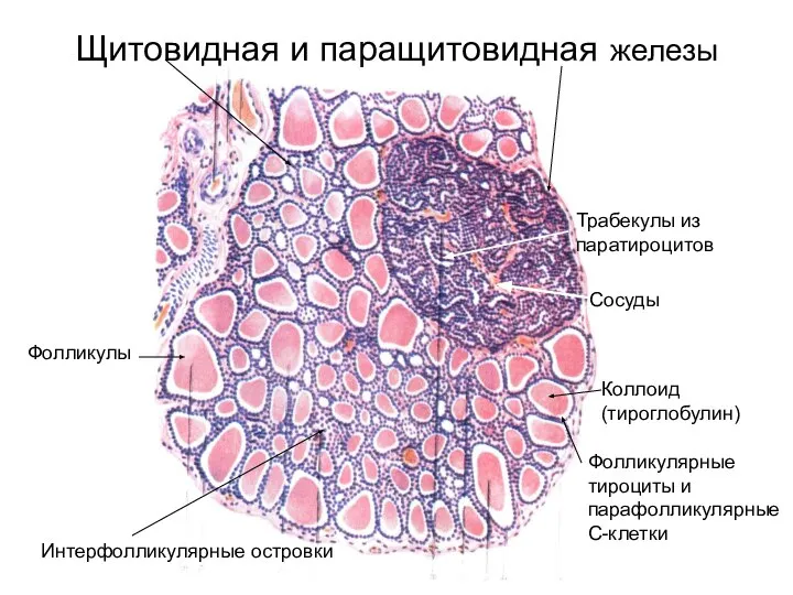 Щитовидная и паращитовидная железы Фолликулы Интерфолликулярные островки Трабекулы из паратироцитов Сосуды Коллоид