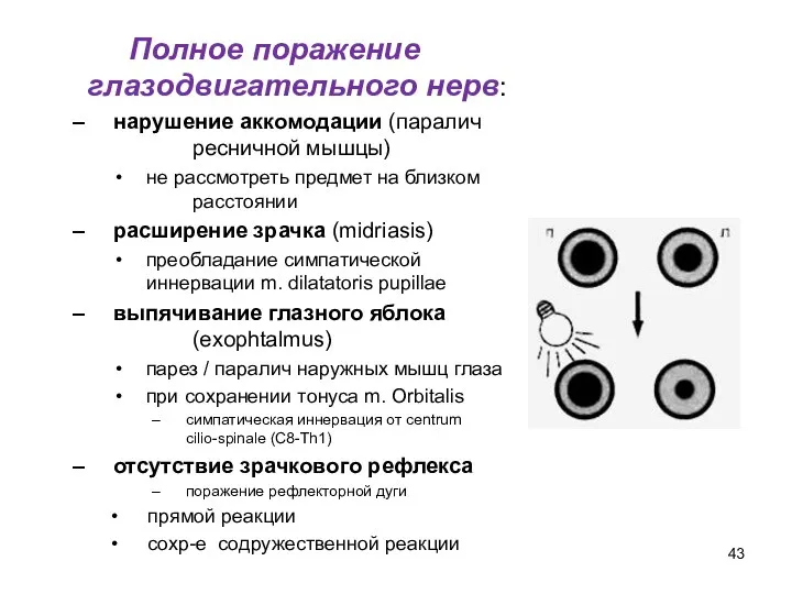 Полное поражение глазодвигательного нерв: нарушение аккомодации (паралич ресничной мышцы) не рассмотреть предмет