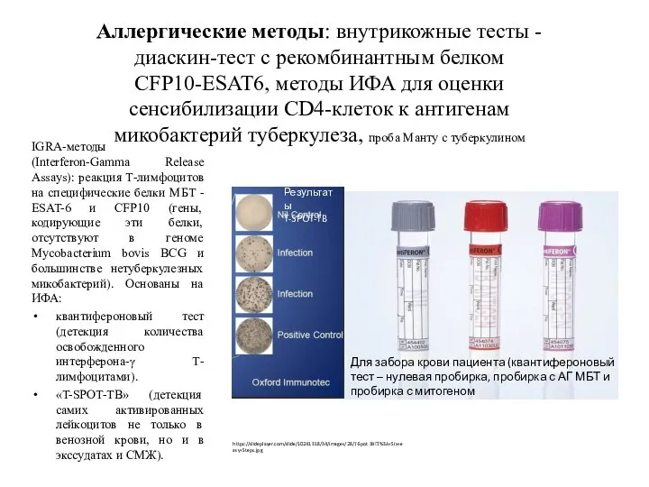 Аллергические методы: внутрикожные тесты -диаскин-тест с рекомбинантным белком CFP10-ESAT6, методы ИФА для