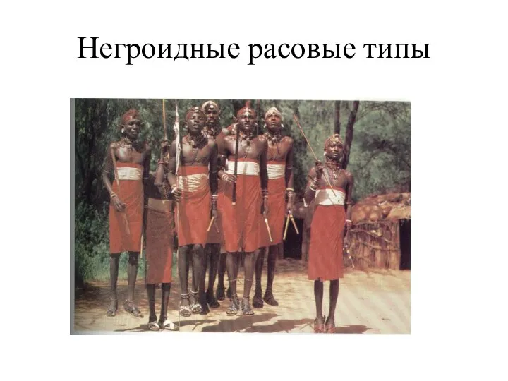 Негроидные расовые типы