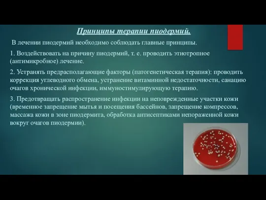 Принципы терапии пиодермий. В лечении пиодермий необходимо соблюдать главные принципы. 1. Воздействовать