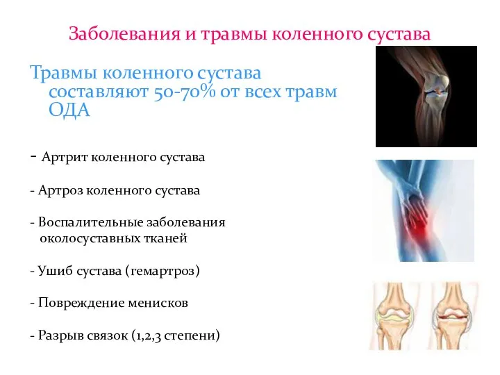 Заболевания и травмы коленного сустава Травмы коленного сустава составляют 50-70% от всех