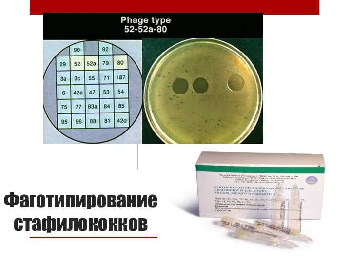 Фаготипирование стафилококков