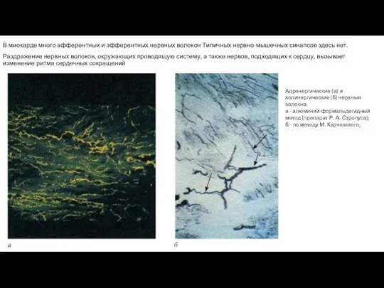 В миокарде много афферентных и эфферентных нервных волокон Типичных нервно-мышечных синапсов здесь