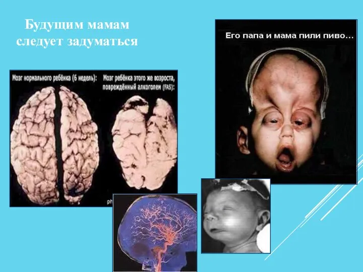 Будущим мамам следует задуматься