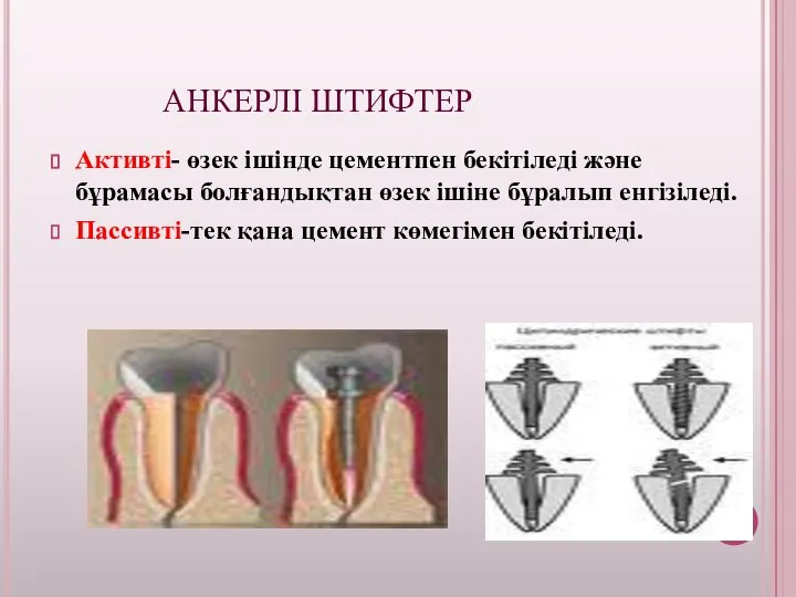 АНКЕРЛІ ШТИФТЕР Активті- өзек ішінде цементпен бекітіледі және бұрамасы болғандықтан өзек ішіне