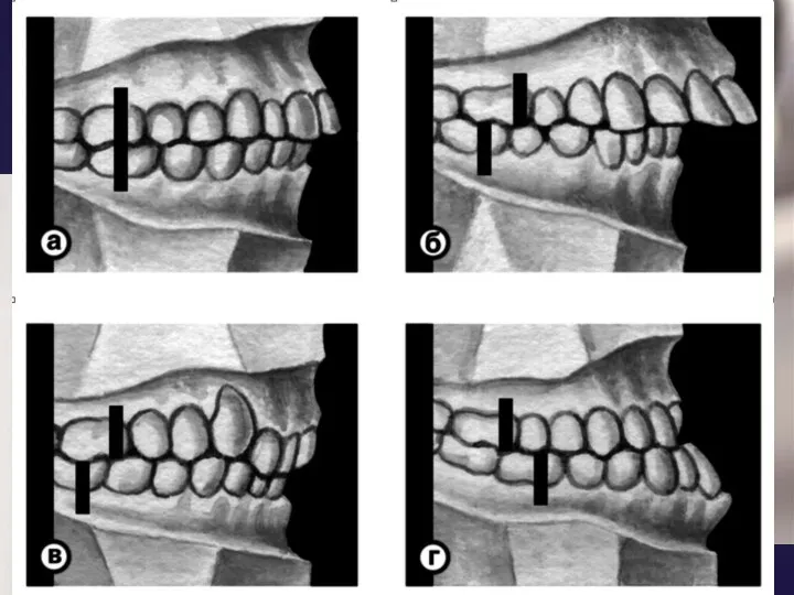 Зубы влияют на форму губ. Постоянных зубов 32: в каждой половине зубного