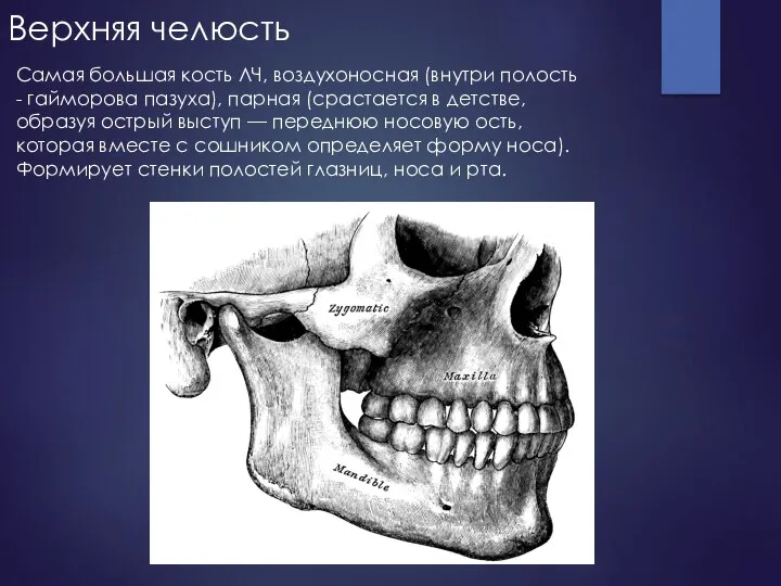 Верхняя челюсть Самая большая кость ЛЧ, воздухоносная (внутри полость - гайморова пазуха),