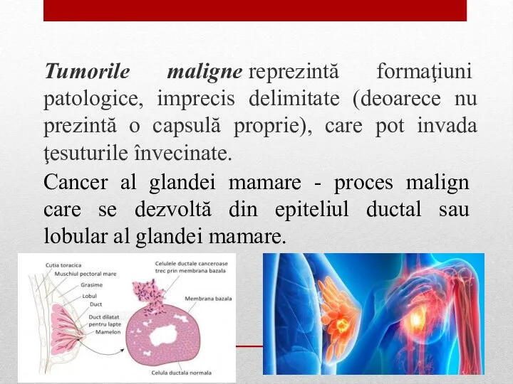 Tumorile maligne reprezintă formaţiuni patologice, imprecis delimitate (deoarece nu prezintă o capsulă