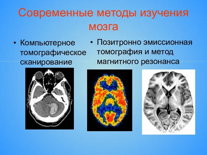Современные методы изучения мозга Компьютерное томографическое сканирование Позитронно эмиссионная томография и метод магнитного резонанса