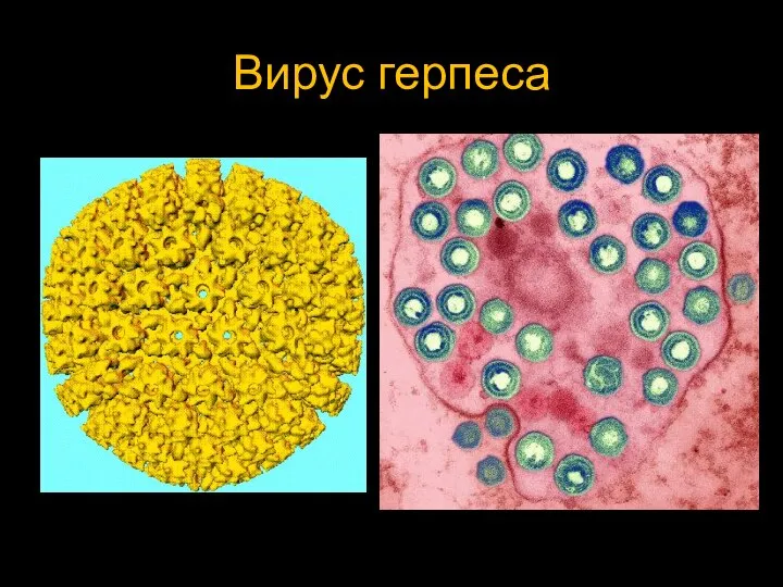 Вирус герпеса