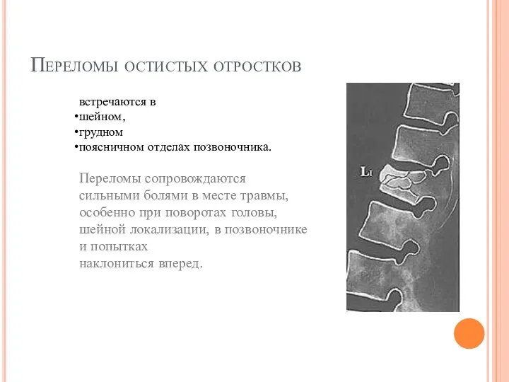 Переломы остистых отростков встречаются в шейном, грудном поясничном отделах позвоночника. Переломы сопровождаются