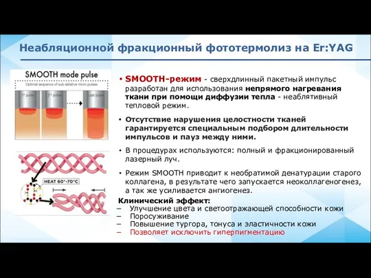 Неабляционной фракционный фототермолиз на Er:YAG SMOOTH-режим - cверхдлинный пакетный импульс разработан для