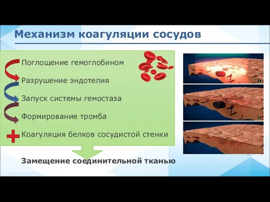 Поглощение гемоглобином Разрушение эндотелия Запуск системы гемостаза Формирование тромба Коагуляция белков сосудистой