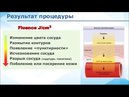 Результат процедуры Изменение цвета сосуда Размытие контуров Появление «пунктирности» Исчезновение сосуда Разрыв