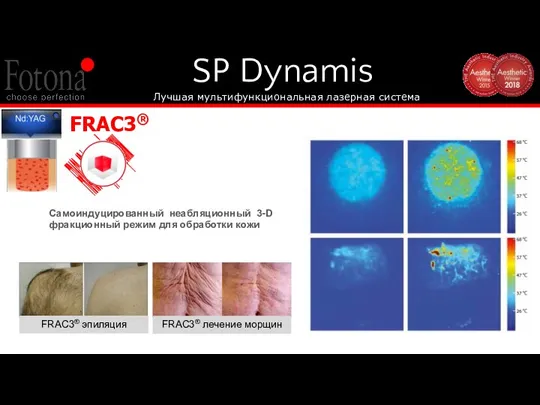 SP Dynamis Лучшая мультифункциональная лазерная система Самоиндуцированный неабляционный 3-D фракционный режим для