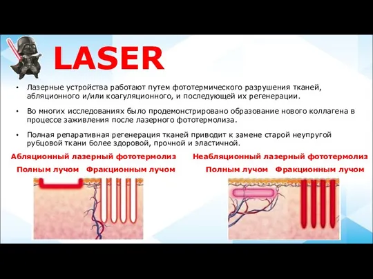 LASER Неабляционный лазерный фототермолиз Полным лучом Фракционным лучом Абляционный лазерный фототермолиз Полным