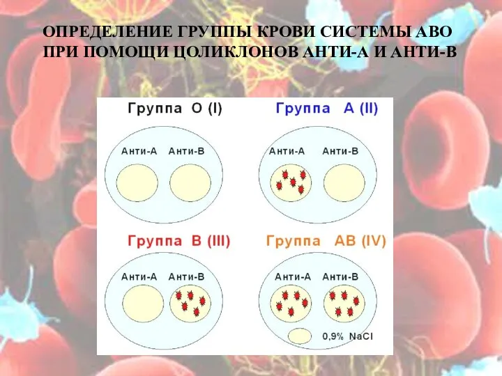 ОПРЕДЕЛЕНИЕ ГРУППЫ КРОВИ СИСТЕМЫ АВО ПРИ ПОМОЩИ ЦОЛИКЛОНОВ АНТИ-А И АНТИ-В