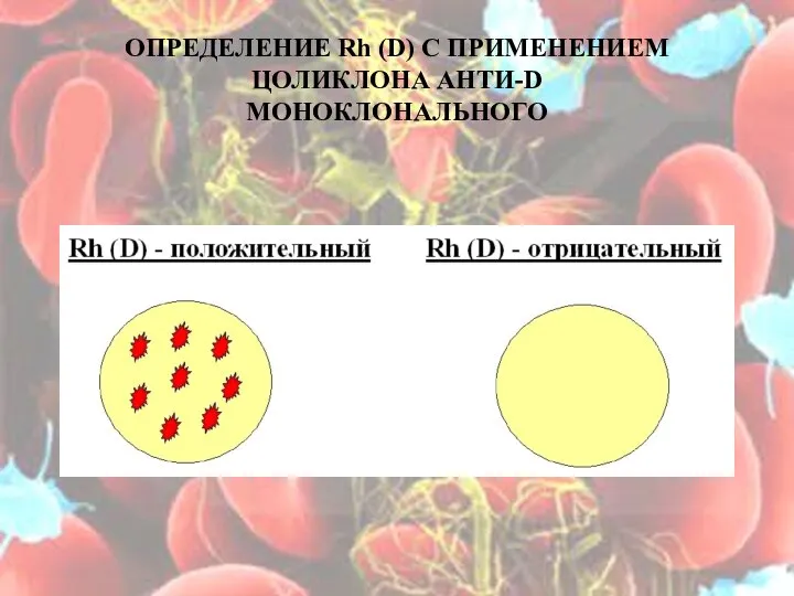 ОПРЕДЕЛЕНИЕ Rh (D) С ПРИМЕНЕНИЕМ ЦОЛИКЛОНА АНТИ-D МОНОКЛОНАЛЬНОГО