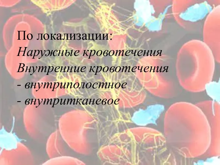 По локализации: Наружные кровотечения Внутренние кровотечения - внутриполостное - внутритканевое