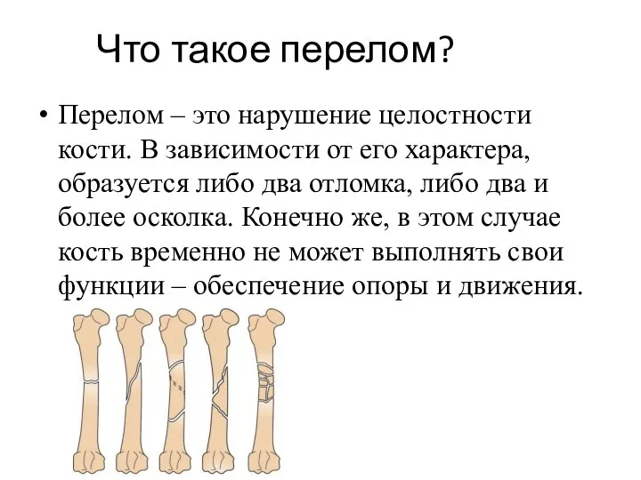 Что такое перелом? Перелом – это нарушение целостности кости. В зависимости от