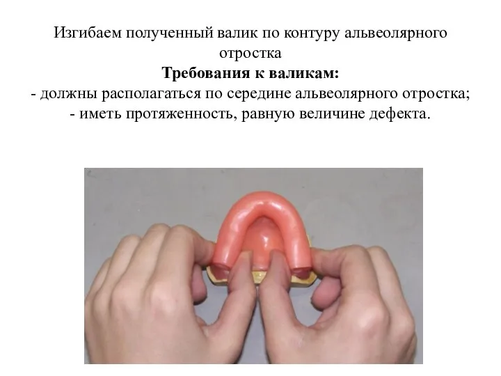 Изгибаем полученный валик по контуру альвеолярного отростка Требования к валикам: - должны