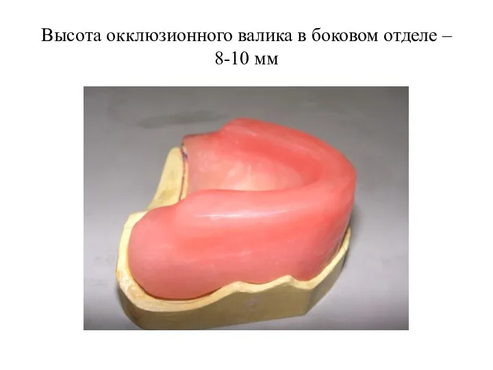 Высота окклюзионного валика в боковом отделе – 8-10 мм