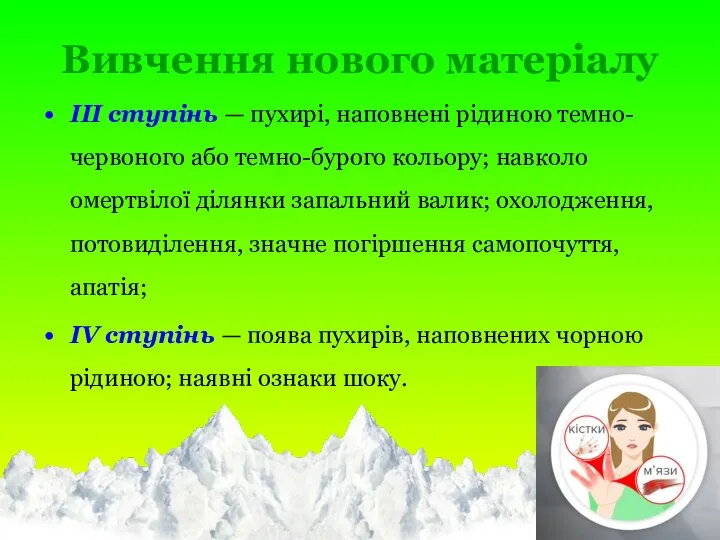 Вивчення нового матеріалу III ступінь — пухирі, наповнені рідиною темно-червоного або темно-бурого