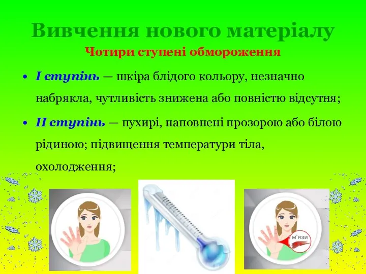 Вивчення нового матеріалу Чотири ступені обмороження І ступінь — шкіра блідого кольору,